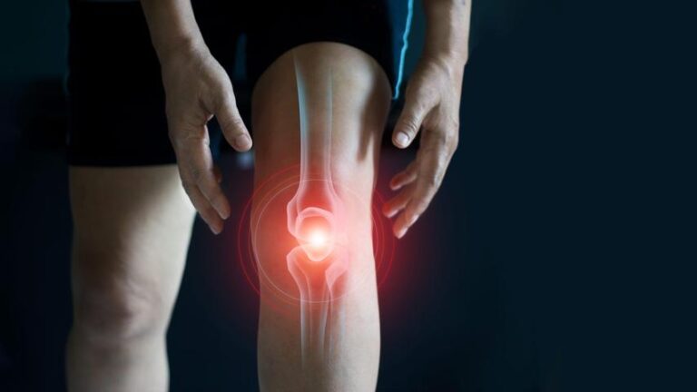 Arthritis vs. General Joint Pain: Key Differences You Should Know