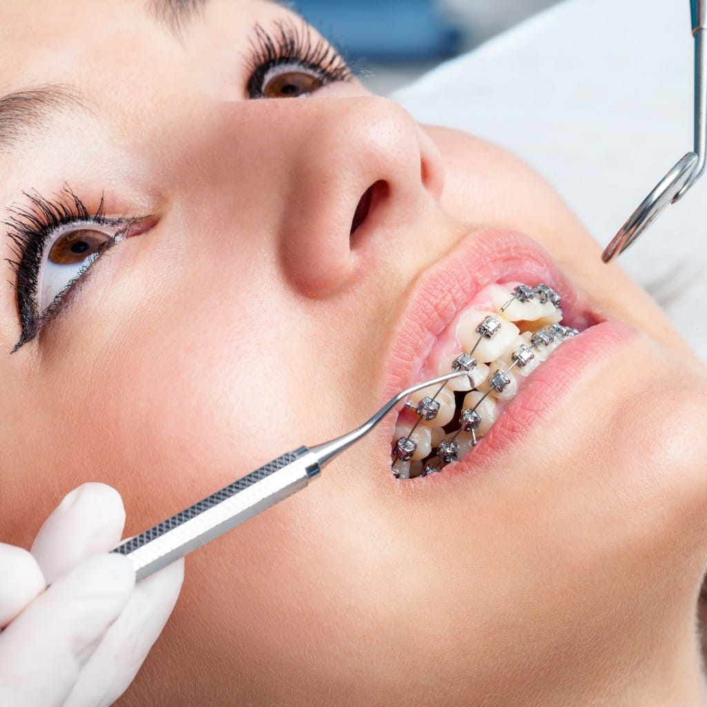 What to Look for in a Good Dentist: Tips for Finding the Right Fit