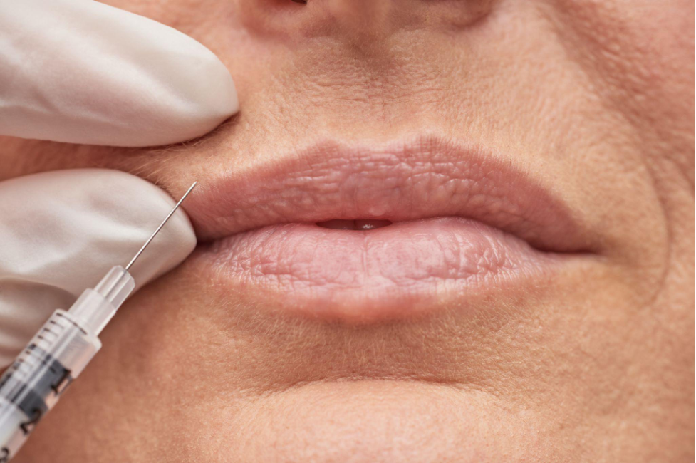 Med Spa Solutions for Fine Lines and Wrinkles